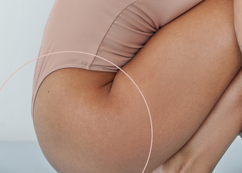 sculptra before and after